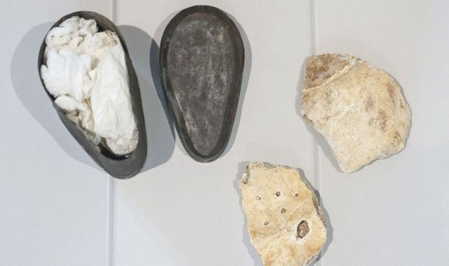 Presumed Beethoven Skull Fragments Return to Vienna